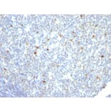 Immunohistochemistry - Anti-Human IgM Heavy Chain Antibody [IM260] - BSA and Azide free (A248960) - Antibodies.com