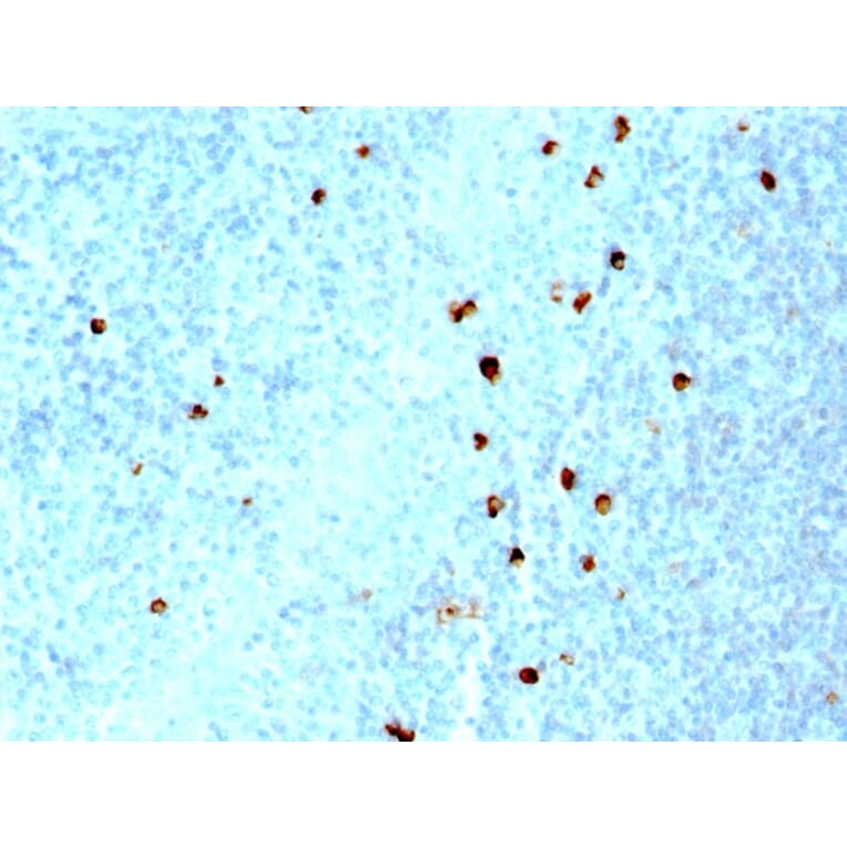 Immunohistochemistry - Anti-Human IgM Heavy Chain Antibody [SPM557] - BSA and Azide free (A248961) - Antibodies.com