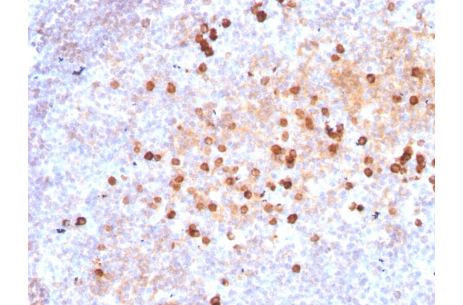 Immunohistochemistry - Anti-Human IgM Heavy Chain Antibody [IM373] - BSA and Azide free (A252141) - Antibodies.com