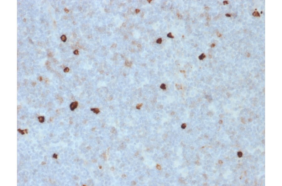 Immunohistochemistry - Anti-Human IgM Heavy Chain Antibody [R1/69] - BSA and Azide free (A252143) - Antibodies.com