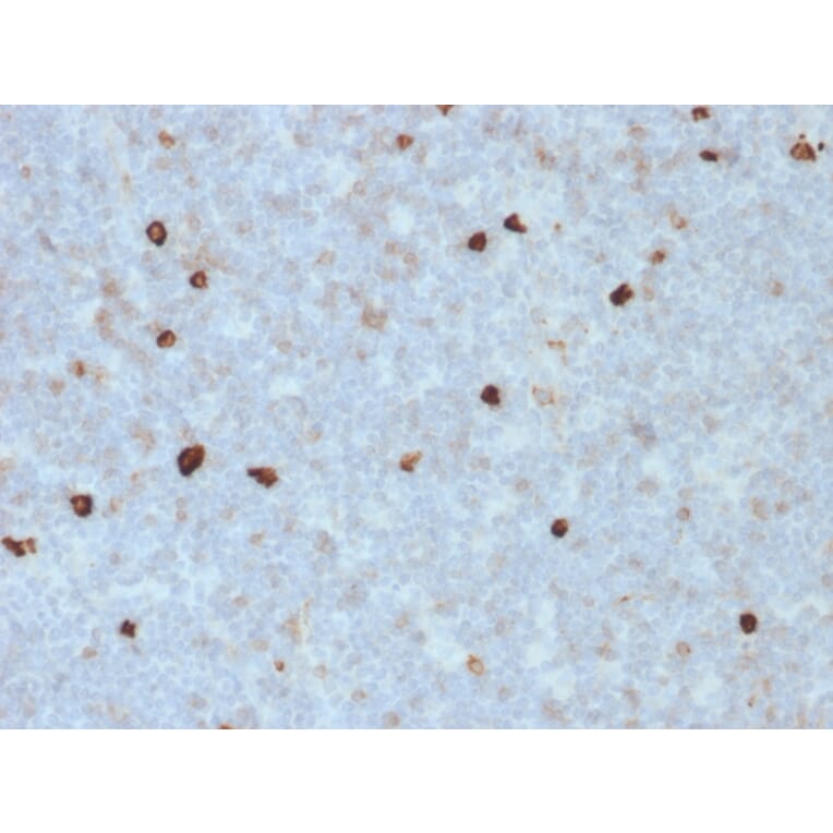 Immunohistochemistry - Anti-Human IgM Heavy Chain Antibody [R1/69] - BSA and Azide free (A252143) - Antibodies.com
