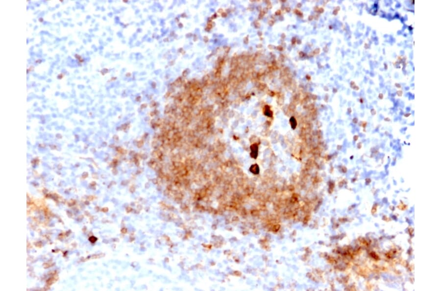 Immunohistochemistry - Anti-Human IgM Heavy Chain Antibody [rIGHM/2558] - BSA and Azide free (A252146) - Antibodies.com