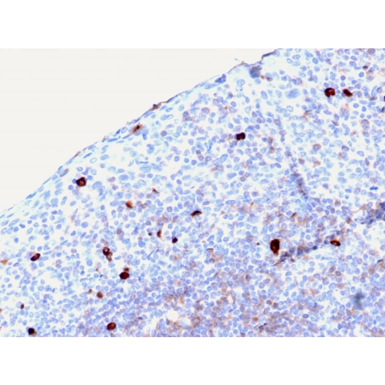 Immunohistochemistry - Anti-Human IgM Heavy Chain Antibody [rIGHM/2558] - BSA and Azide free (A252145) - Antibodies.com