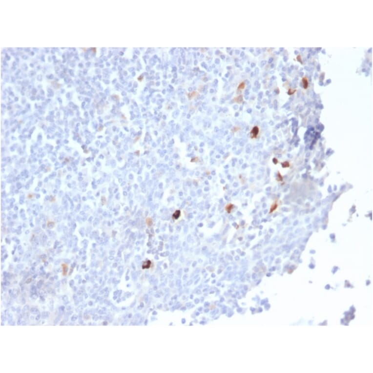 Immunohistochemistry - Anti-Human IgM Heavy Chain Antibody [IGHM/2559R] - BSA and Azide free (A252146) - Antibodies.com