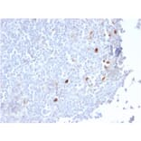 Immunohistochemistry - Anti-Human IgM Heavy Chain Antibody [IGHM/2559R] - BSA and Azide free (A252146) - Antibodies.com