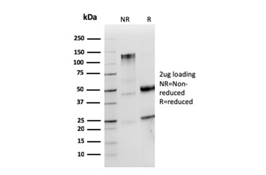 SDS-PAGE - Anti-Human IgM Heavy Chain Antibody [IGHM/2559R] - BSA and Azide free (A252147) - Antibodies.com