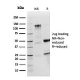 SDS-PAGE - Anti-Human IgM Heavy Chain Antibody [IGHM/2559R] - BSA and Azide free (A252147) - Antibodies.com