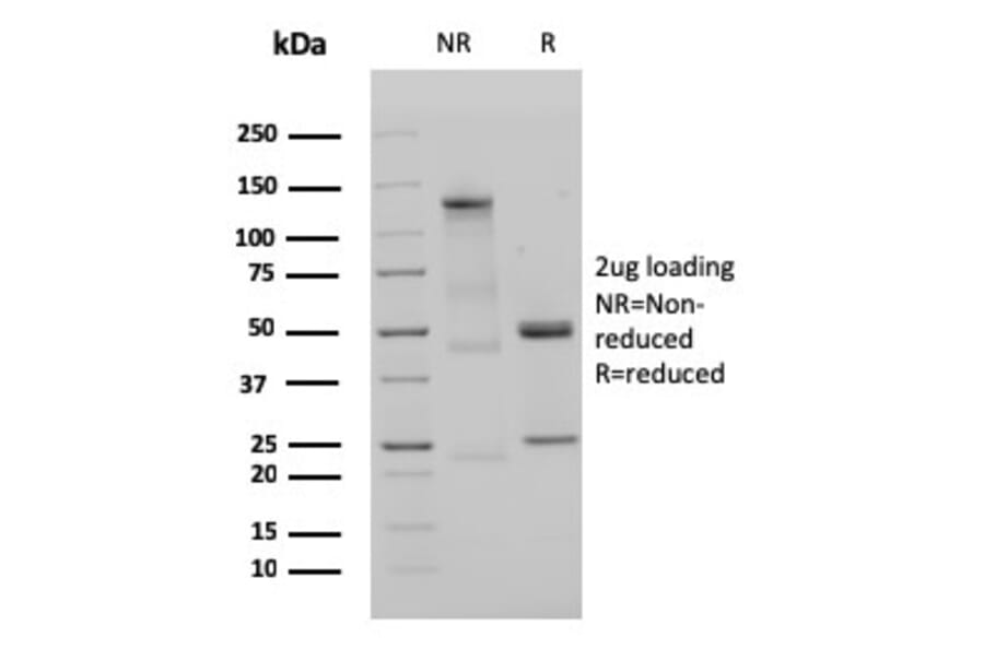 SDS-PAGE - Anti-Human IgM Heavy Chain Antibody [IGHM/3135R] - BSA and Azide free (A252148) - Antibodies.com