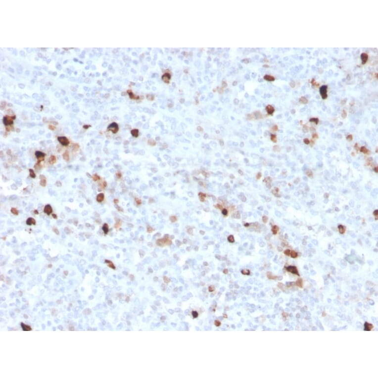 Immunohistochemistry - Anti-Human IgM Heavy Chain Antibody [IGHM/3776R] - BSA and Azide free (A252149) - Antibodies.com
