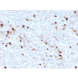 Immunohistochemistry - Anti-Human IgM Heavy Chain Antibody [IGHM/3776R] - BSA and Azide free (A252149) - Antibodies.com