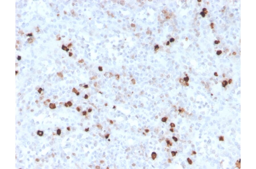 Immunohistochemistry - Anti-Human IgM Heavy Chain Antibody [IGHM/3776R] - BSA and Azide free (A252148) - Antibodies.com