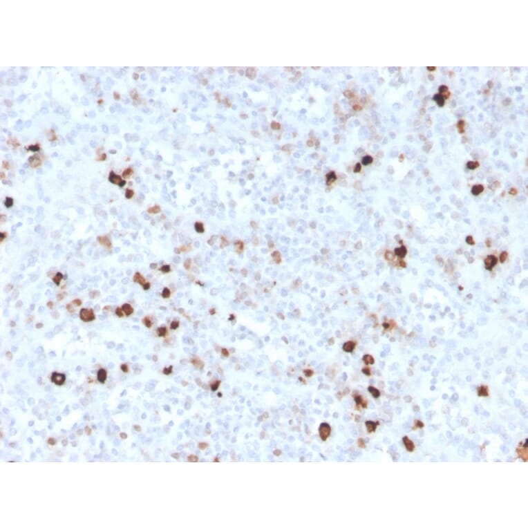 Immunohistochemistry - Anti-Human IgM Heavy Chain Antibody [IGHM/3776R] - BSA and Azide free (A252148) - Antibodies.com
