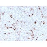 Immunohistochemistry - Anti-Human IgM Heavy Chain Antibody [IGHM/3776R] - BSA and Azide free (A252148) - Antibodies.com
