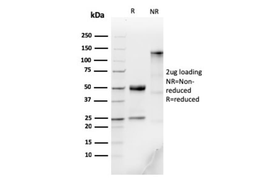 SDS-PAGE - Anti-Human IgM Heavy Chain Antibody [IGHM/3776R] - BSA and Azide free (A252149) - Antibodies.com