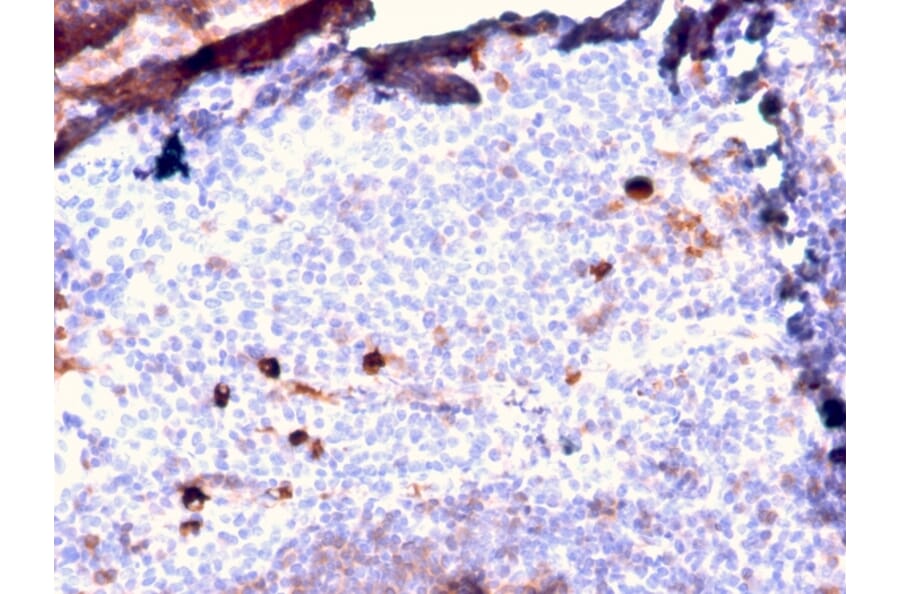 Immunohistochemistry - Anti-Human IgM Heavy Chain Antibody [IGHM/2557R] - BSA and Azide free (A252151) - Antibodies.com