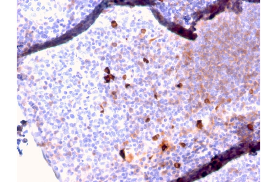 Immunohistochemistry - Anti-Human IgM Heavy Chain Antibody [IGHM/2557R] - BSA and Azide free (A252150) - Antibodies.com