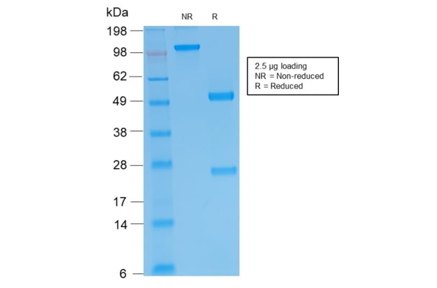 SDS-PAGE - Anti-Human IgM Heavy Chain Antibody [IGHM/2557R] - BSA and Azide free (A252151) - Antibodies.com