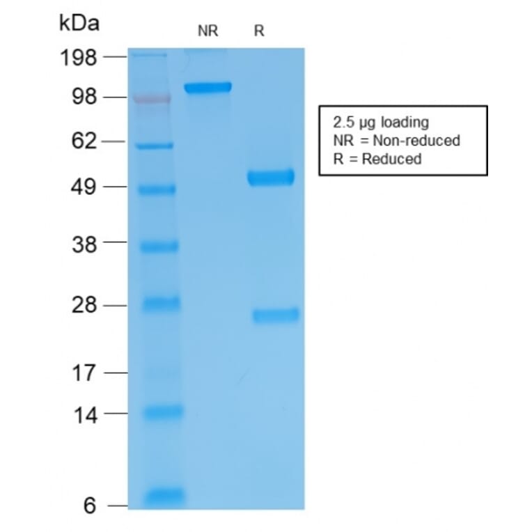 SDS-PAGE - Anti-Human IgM Heavy Chain Antibody [IGHM/2557R] - BSA and Azide free (A252151) - Antibodies.com