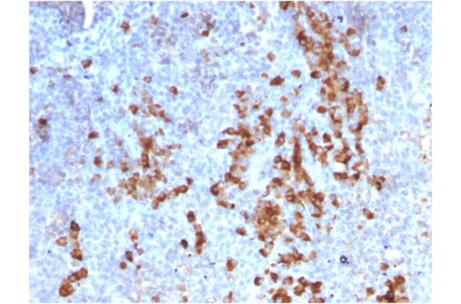 Immunohistochemistry - Anti-Kappa Light Chain Antibody [rKLC709] - BSA and Azide free (A252152) - Antibodies.com