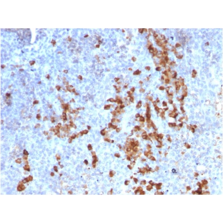 Immunohistochemistry - Anti-Kappa Light Chain Antibody [rKLC709] - BSA and Azide free (A252152) - Antibodies.com