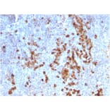 Immunohistochemistry - Anti-Kappa Light Chain Antibody [rKLC709] - BSA and Azide free (A252152) - Antibodies.com