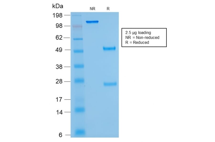 SDS-PAGE - Anti-Kappa Light Chain Antibody [rKLC264] - BSA and Azide free (A252153) - Antibodies.com