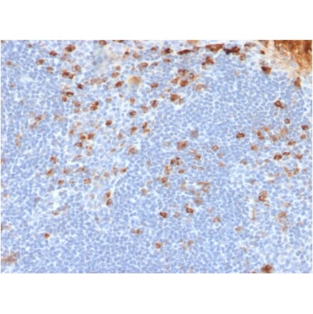 Immunohistochemistry - Anti-Kappa Light Chain Antibody [rL1C1] - BSA and Azide free (A252154) - Antibodies.com