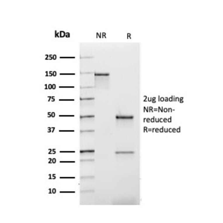 SDS-PAGE - Anti-Kappa Light Chain Antibody [rL1C1] - BSA and Azide free (A252154) - Antibodies.com