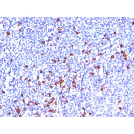 Immunohistochemistry - Anti-Kappa Light Chain Antibody [SPM508] - BSA and Azide free (A252155) - Antibodies.com