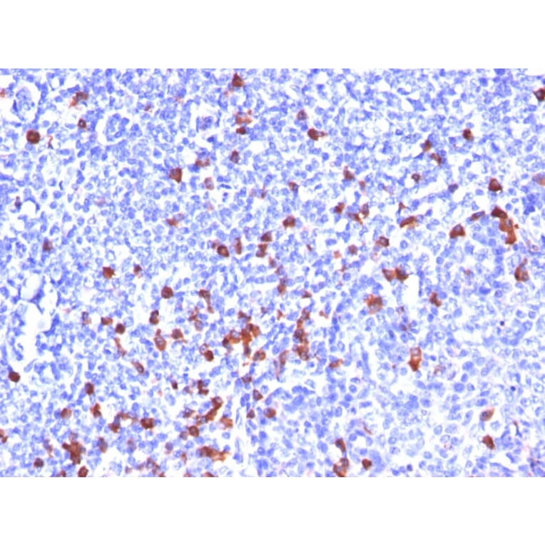Immunohistochemistry - Anti-Kappa Light Chain Antibody [SPM508] - BSA and Azide free (A252155) - Antibodies.com