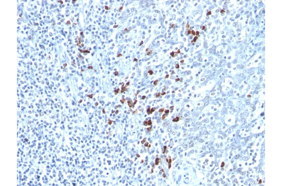 Immunohistochemistry - Anti-Kappa Light Chain Antibody [KLC264] - BSA and Azide free (A252157) - Antibodies.com