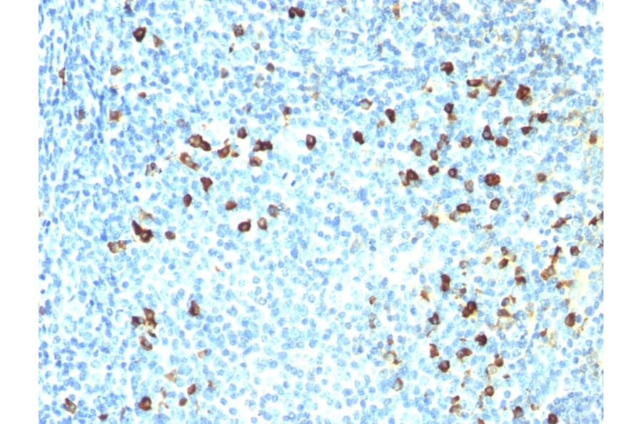 Immunohistochemistry - Anti-Kappa Light Chain Antibody [SPM558] - BSA and Azide free (A252157) - Antibodies.com