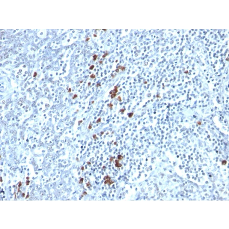 Immunohistochemistry - Anti-Kappa Light Chain Antibody [TB28-2] - BSA and Azide free (A252158) - Antibodies.com