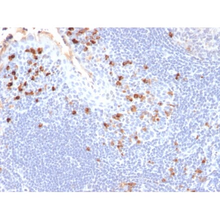 Immunohistochemistry - Anti-Kappa Light Chain Antibody [HP6053] - BSA and Azide free (A252159) - Antibodies.com