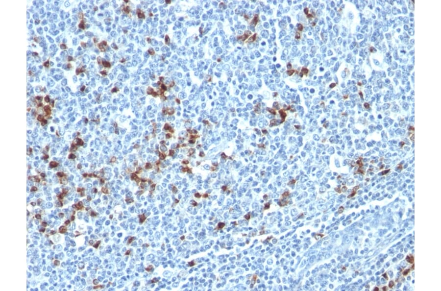 Immunohistochemistry - Anti-Kappa Light Chain Antibody [HP6053 + L1C1] - BSA and Azide free (A252160) - Antibodies.com