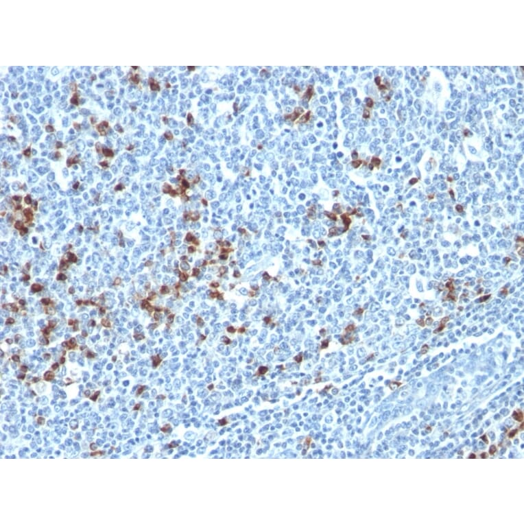 Immunohistochemistry - Anti-Kappa Light Chain Antibody [HP6053 + L1C1] - BSA and Azide free (A252160) - Antibodies.com