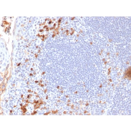 Immunohistochemistry - Anti-Kappa Light Chain Antibody [KLC709] - BSA and Azide free (A252162) - Antibodies.com