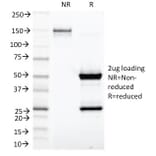 SDS-PAGE - Anti-Kappa Light Chain Antibody [KLC1278] - BSA and Azide free (A252164) - Antibodies.com