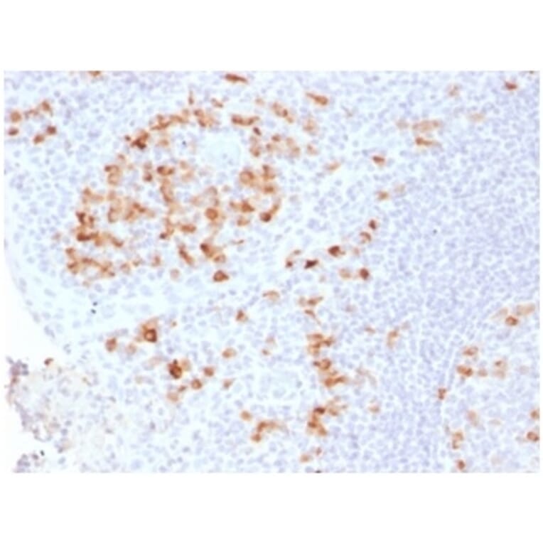 Immunohistochemistry - Anti-Kappa Light Chain Antibody [KLC2289R] - BSA and Azide free (A252164) - Antibodies.com