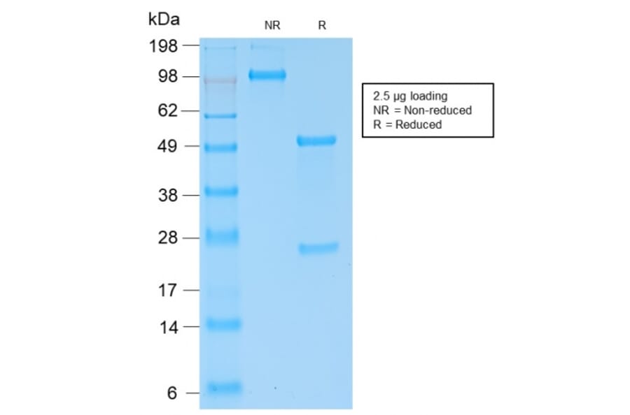 SDS-PAGE - Anti-Kappa Light Chain Antibody [KLC2289R] - BSA and Azide free (A252165) - Antibodies.com