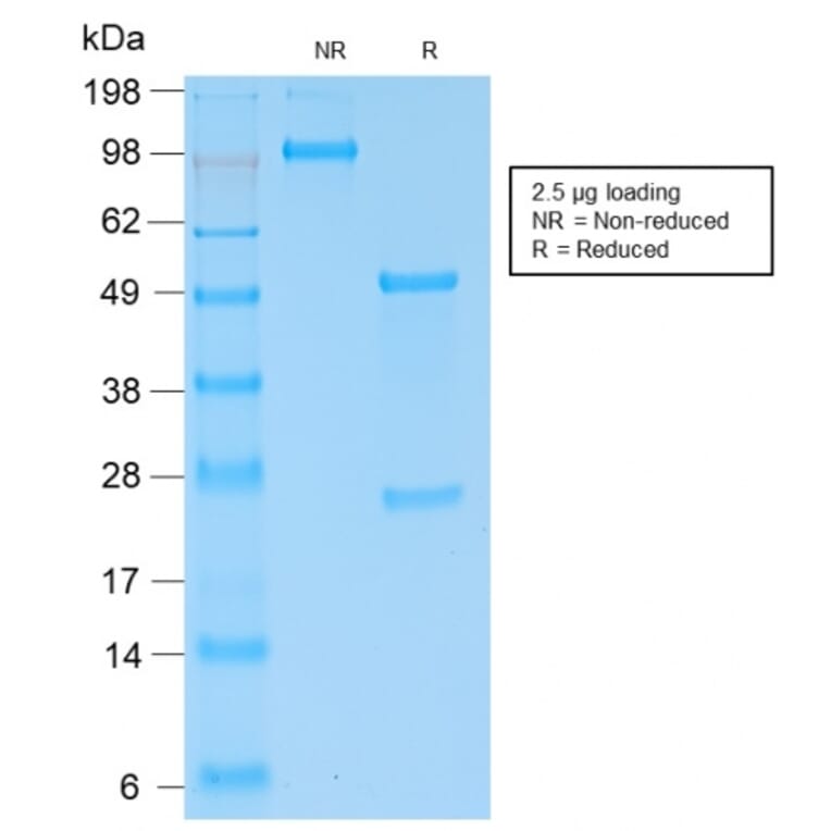 SDS-PAGE - Anti-Kappa Light Chain Antibody [KLC2289R] - BSA and Azide free (A252165) - Antibodies.com