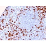 Immunohistochemistry - Anti-Kappa Light Chain Antibody [KLC2886R] - BSA and Azide free (A252165) - Antibodies.com