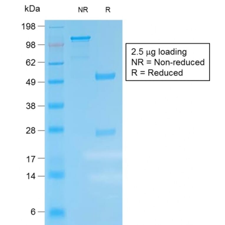 SDS-PAGE - Anti-Kappa Light Chain Antibody [IGKC/1999R] - BSA and Azide free (A252167) - Antibodies.com