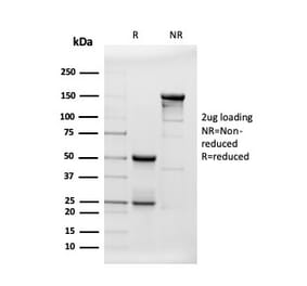 SDS-PAGE - Anti-beta Amyloid Antibody [APP/3343] - BSA and Azide free (A252168) - Antibodies.com