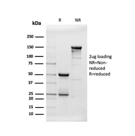 SDS-PAGE - Anti-beta Amyloid Antibody [APP/3343] - BSA and Azide free (A252168) - Antibodies.com