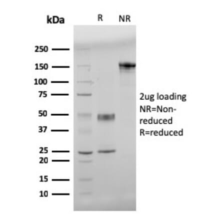 SDS-PAGE - Anti-beta Amyloid Antibody [APP/3345] - BSA and Azide free (A252169) - Antibodies.com