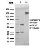 SDS-PAGE - Anti-beta Amyloid Antibody [APP/3345] - BSA and Azide free (A252169) - Antibodies.com