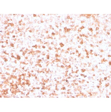 Immunohistochemistry - Anti-Lambda Light Chain Antibody [rLLC/3777] - BSA and Azide free (A252169) - Antibodies.com