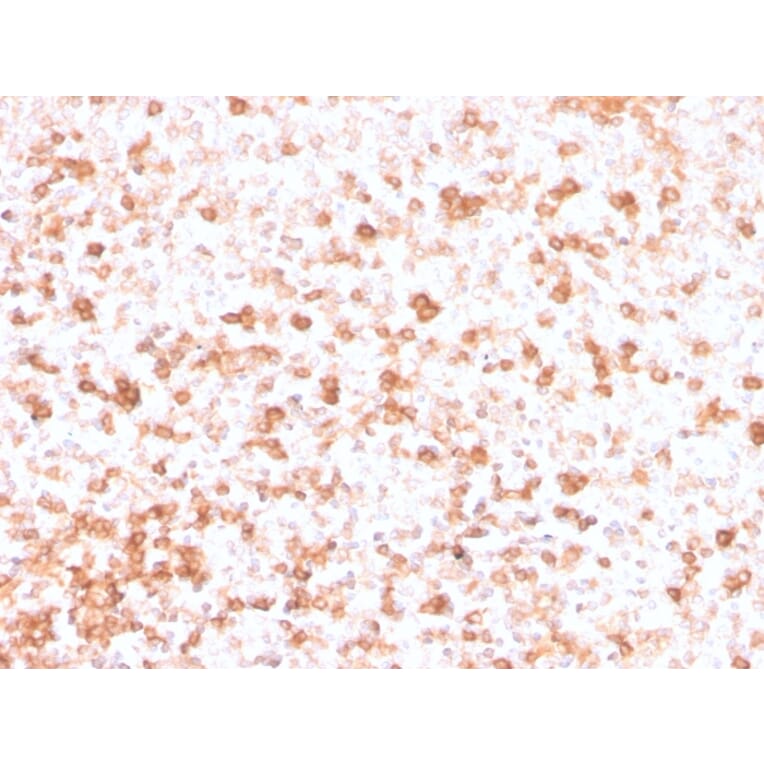 Immunohistochemistry - Anti-Lambda Light Chain Antibody [rLLC/3777] - BSA and Azide free (A252169) - Antibodies.com