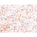 Immunohistochemistry - Anti-Lambda Light Chain Antibody [rLLC/3777] - BSA and Azide free (A252169) - Antibodies.com